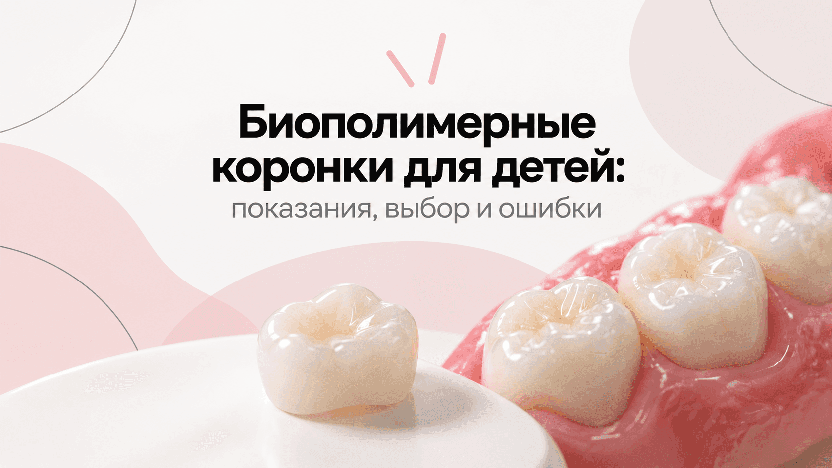 Биополимерные коронки для детей: показания, выбор и ошибки